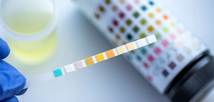 فحص ما قبل التوظيف بالرياض